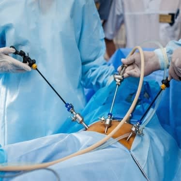 Laparoscopic GI Surgery